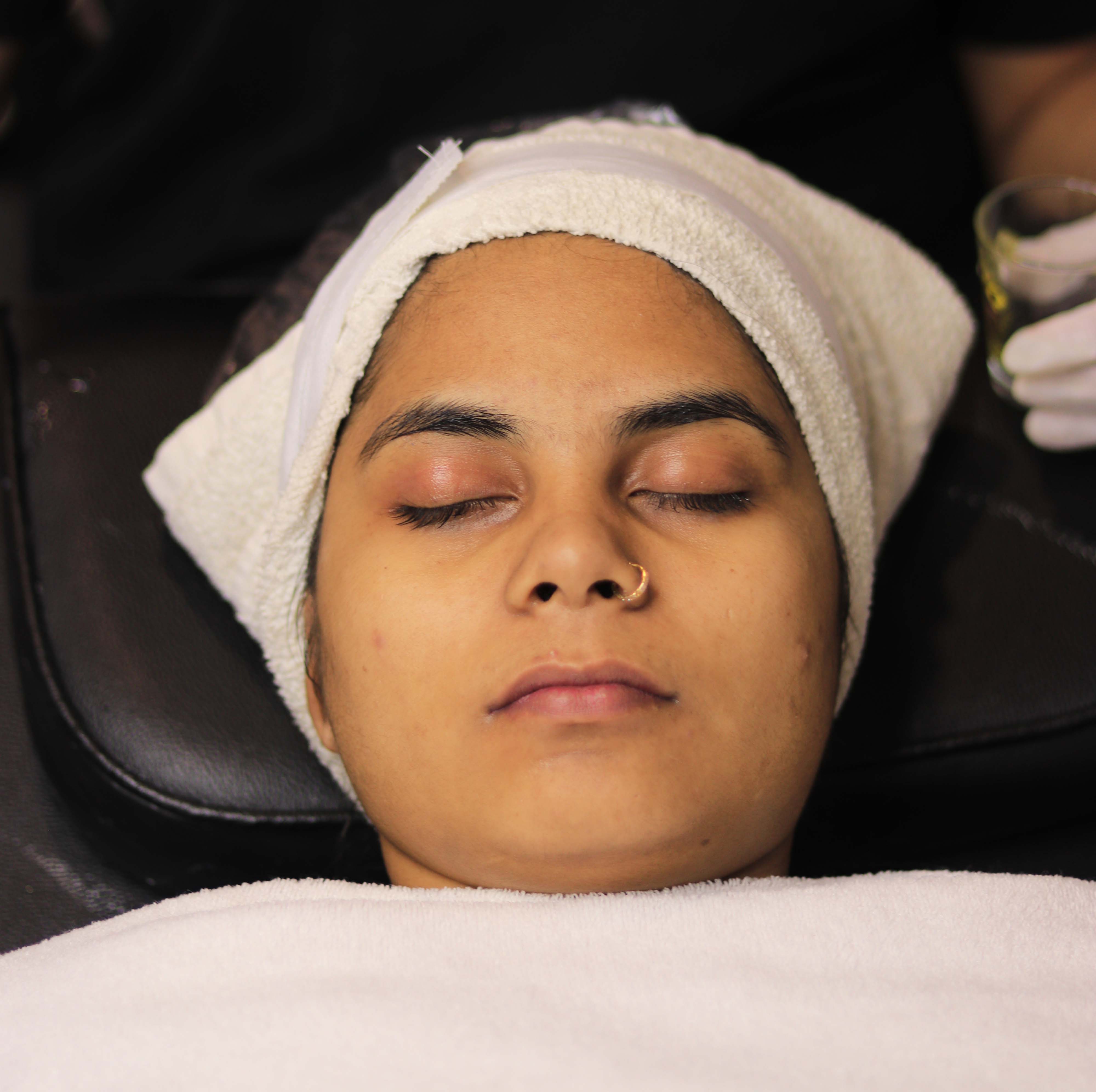 Skin Treatments